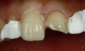  mg 3623 gngnzw - Eugenol