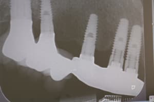  mg 6890 ovpsfb - Eugenol