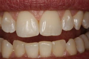  mg 7936  desktop resolution  mqu7oa - Eugenol