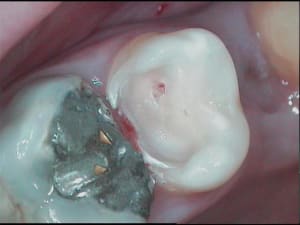  as percé  tss ywv7ta - Eugenol