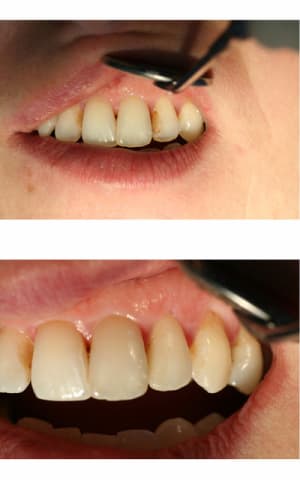  images hs1aii - Eugenol