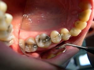  inutile avant vxuvgk - Eugenol