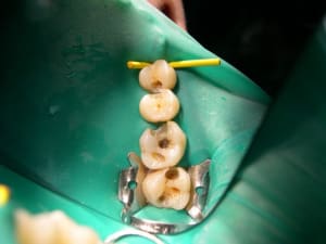  inutile pendant adocwl - Eugenol