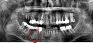 A4pzfzap5a3n7wm1rygv - Eugenol