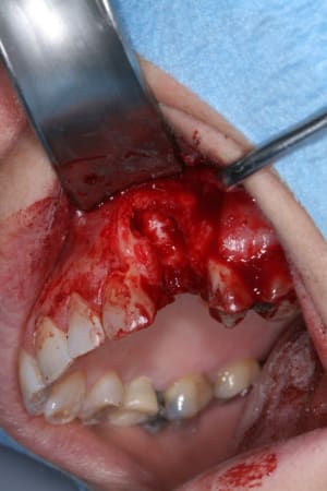 Alv ole nettoy e fnw3s8 - Eugenol