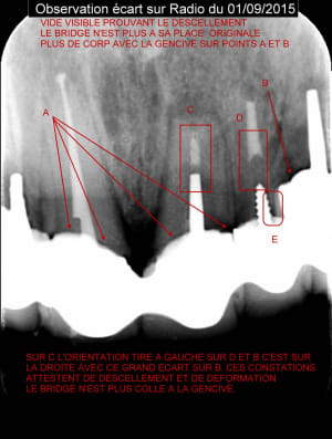 Analyse jugsd7 - Eugenol
