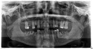 Atzxleppdhjeu8kvx4be - Eugenol