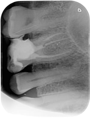 Auxufsovg0inphp0xj7y - Eugenol