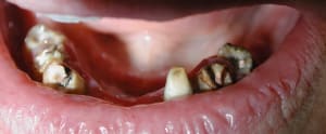 Avant2 goe2kr - Eugenol