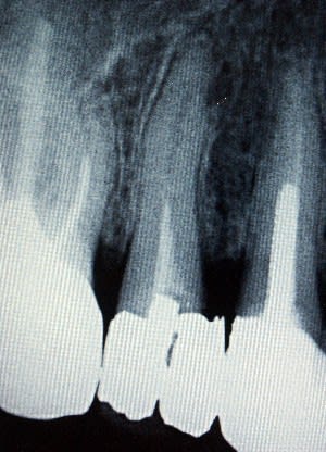 Avantrte15 t6ar1f - Eugenol