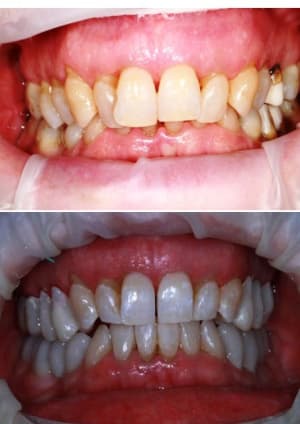 Avap1 zfkpck - Eugenol