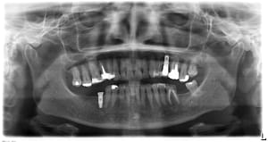 B6d9yeksr21bz8zjhidx - Eugenol