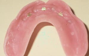 Barre haut04 at93ci - Eugenol