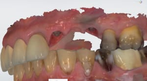 Bat3 tewdak - Eugenol