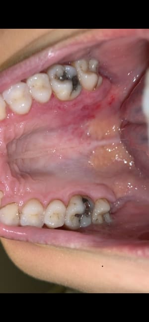 Bokkz6cryycsb0flh8n7 - Eugenol