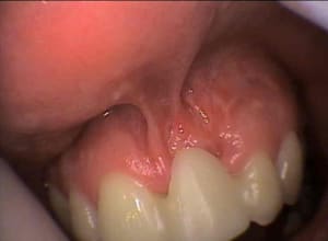 Brides chir iqdynv - Eugenol