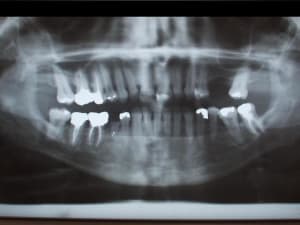 Bspl pano vh0vjl - Eugenol