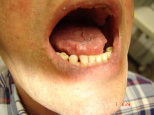 Bu1 tazfdh - Eugenol