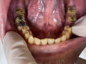 C843cqq006n59ue8fyl0 - Eugenol