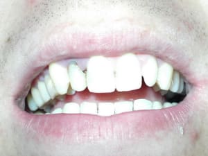 Cal 001 eszlk6 - Eugenol