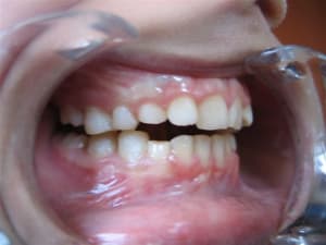 Cales ckyt3a - Eugenol