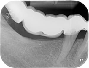 Cantilever x 2012 07 27 10 30 46 3 nbzqiq - Eugenol