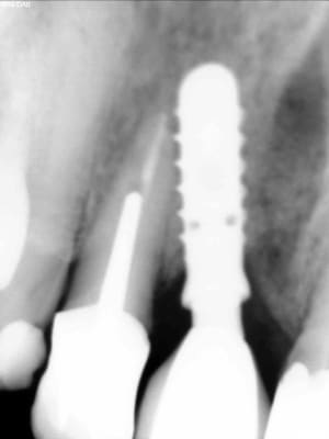 Car4 10 2012 piobvj - Eugenol
