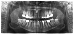 Cbct1 zg8tkg - Eugenol