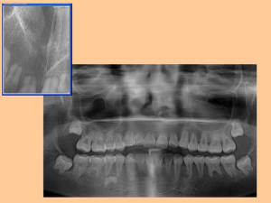 Charlotte aux fraises lh92fd - Eugenol