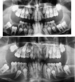 Comparaison yrohzx - Eugenol