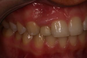 Ct4iov9ujiekgsix8pylq60ozpo7 - Eugenol