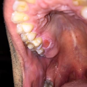 Cueat5v0gviowcshoou8 - Eugenol