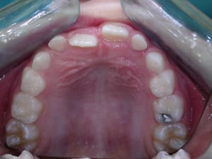 D but  3  h3yk62 - Eugenol