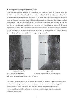 D montage pilier de cicat wnjmlg - Eugenol