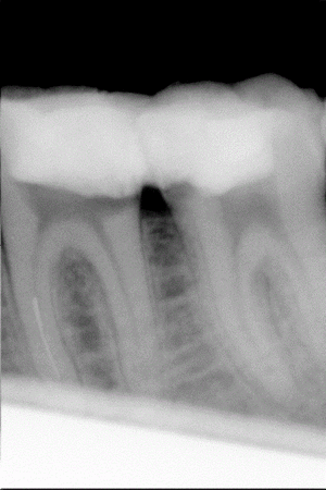 D qqhpm9 - Eugenol