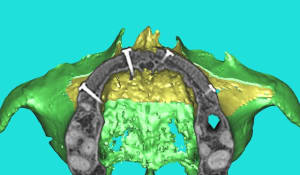 Dar 3d xkb3uv - Eugenol