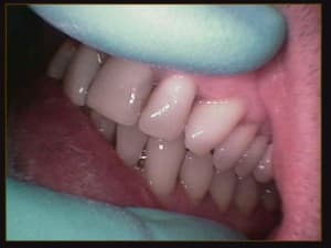 Debut traitement hy3w9q - Eugenol