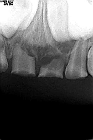 Dec2005 b7rq1y - Eugenol