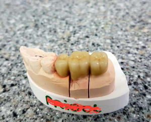 Dent2 qnc8wg - Eugenol