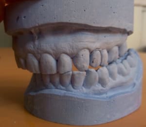 Dents t5ju7t - Eugenol