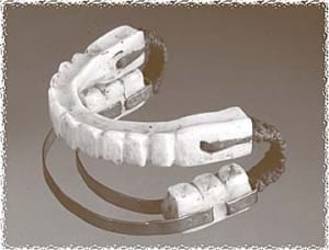 Denture 1 iehkuz - Eugenol