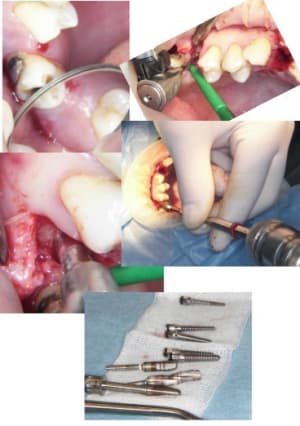 Dia2 jpzdcc - Eugenol
