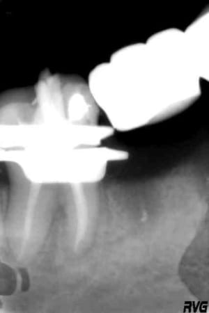 Digue esz1fr - Eugenol