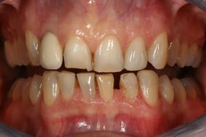 Divers 062 azgkwn - Eugenol