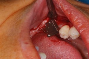 Drapeau easy dufqbd - Eugenol