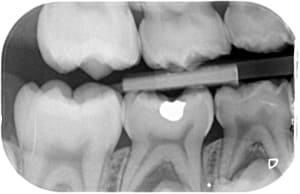 Droit grgz1l - Eugenol