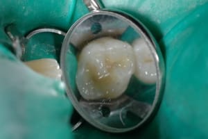 Dsc 2668 yzrnax - Eugenol