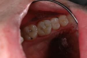 Dsc 2672 tiyfzm - Eugenol