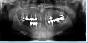 E8fiwuvtkf2p9gr3awai - Eugenol