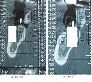 Echelle mq5web - Eugenol